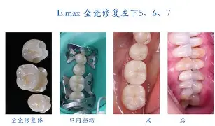 lol-剠?5{+Z&amp;磟;=^寽跾#y?o\(弜嵌洶鯫e鰱龅